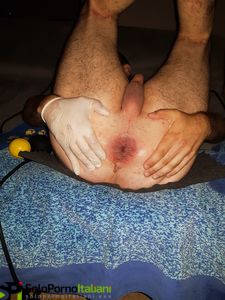 Dilatazione anale
