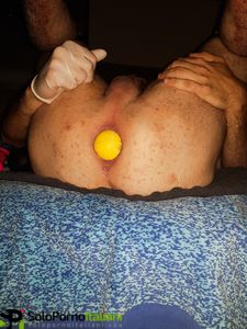 Dilatazione anale