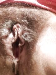 Mostro la sua patata pelosa