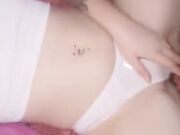 Mi sono bruciata le tette