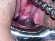 Pussy extreme