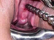 Pussy extreme