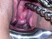 Pussy extreme