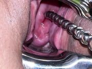 Pussy extreme