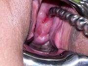 Pussy extreme