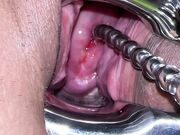 Pussy extreme