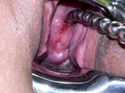 Pussy extreme