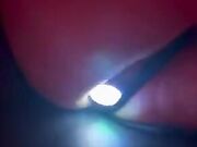 Plug anale luminoso così non la perdo di notte