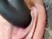 Sgrillettamento clitoride